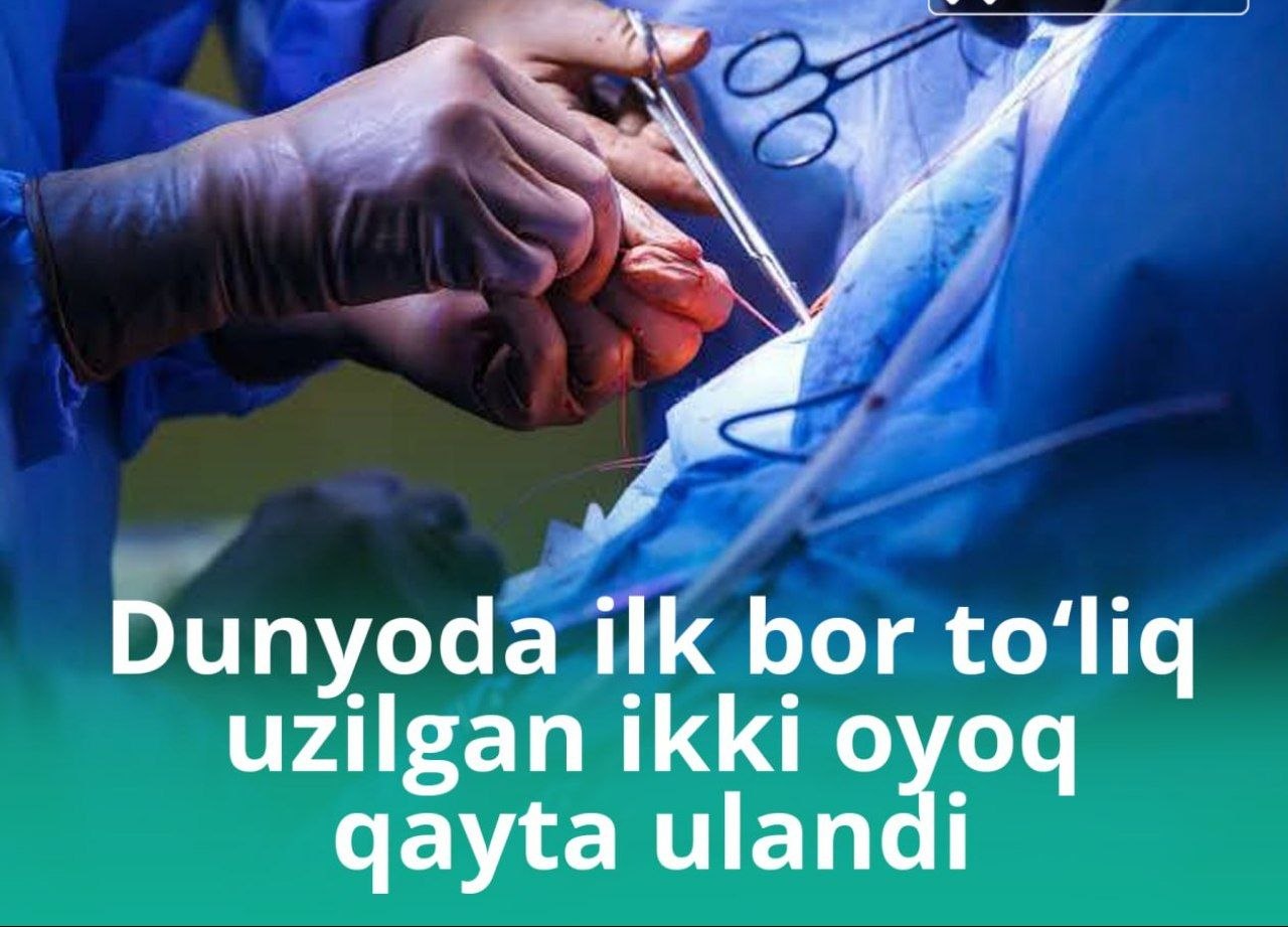 ⚡️ Dunyoda ilk bor son qismidan to‘liq uzilgan ikki oyoq bir vaqtning o‘zida qayta ulandi